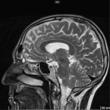 MenschenPelle avatar